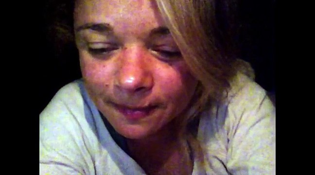 Documental. My beautiful broken brain Parte 1