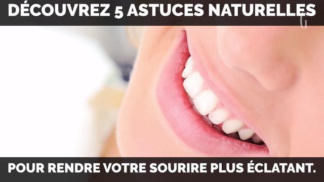 Découvrez 5 astuces pour avoir les dents plus blanches