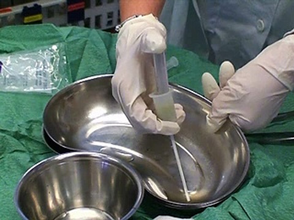 Catheterization of the Urethra in Girls