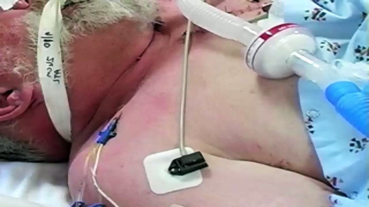 Central Venous Catheterization