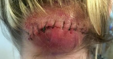 Cette jeune femme était au bord de la mort après des mauvaises consultations chez 4 médecins, mais le 5ème lui a sauvé la vie..