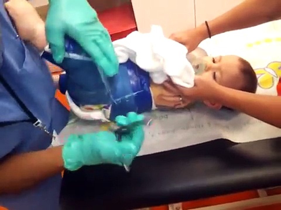 Sydney getting her Spica cast off!