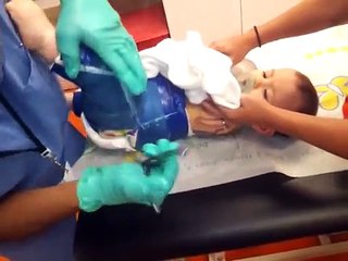 Sydney getting her Spica cast off!