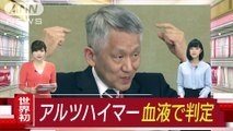 アルツハイマーを血液で判別 “ノーベル”田中氏ら(18-02-01)