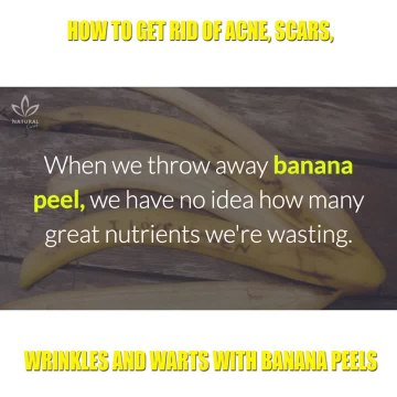 How to Get Rid of Acne, Scars, Wrinkles and Warts with Banana Peels