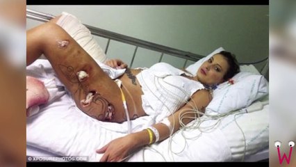 Top 5 Worst Cases Of Plastic Surgery Obsession