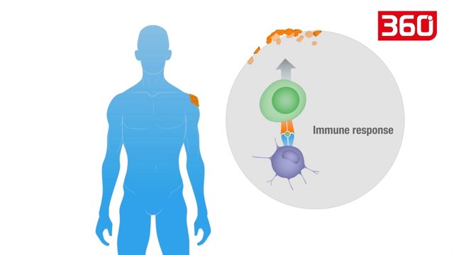 Zbulohet kura kundër kancerit, së shpejti nis prodhimi në masë, por... (360video)