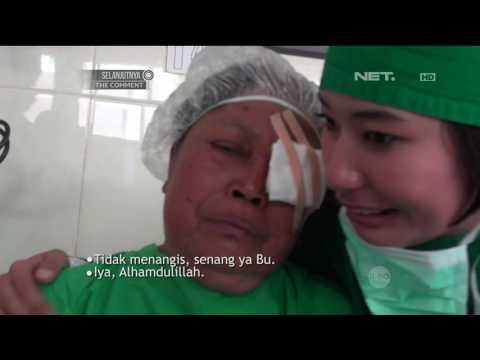 Bakti Sosial Operasi Katarak Gratis Oleh Polres Kediri - 86