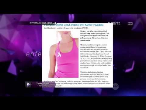 Kepedulian Nina Tamam dan Wulan Guritno terhadap penderita kanker