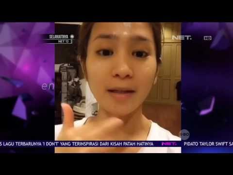 Cerita Bunga Zainal Lepas dari Ketergantungan Obat Kecantikan