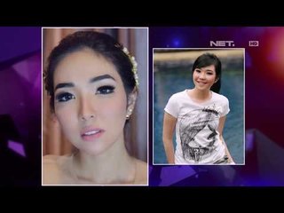 Selebrity yang Melakukan Treatment pada Wajah