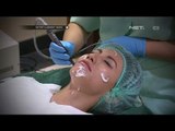 Davina Veronica Jalani Treatment Laser untuk Peremajaan Kulit