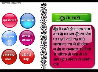 Cancer Video Series Part 2 In Hindi, ओरल कैंसर के बारे में यह जानना बेहद जरुरी है