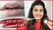 Home Remedy For Chapped Lips | फटे होंठों का इलाज | Beauty Tips In Hindi | घरेलू उपचार