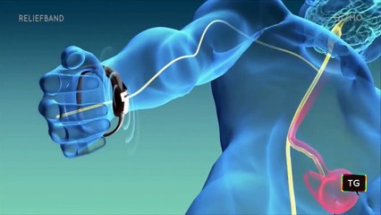 Nausea Relief Technology_ First look at the Reliable Technologies Reliefband at CES 2018 - YouTube (720p)