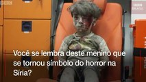 A guerra de propaganda por trás do reaparecimento de menino sírio símbolo do sofrimento da guerra
