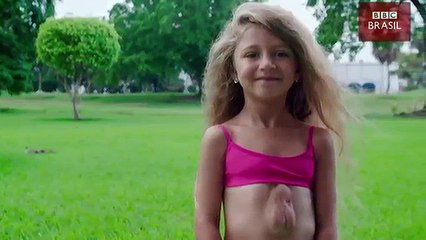 A menina que vive com o coração fora do peito