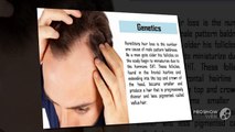 Top 5 Causes Of Male Hair Loss