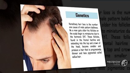 Top 5 Causes Of Male Hair Loss