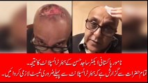 اداکار ساجد حسن کو ہیئرٹرانسپلانٹ کروانا مہنگا پڑ گیا، ساجد حسن نے سوشل میڈیا پر کیا پیغام دیا ویڈیو دیکھیں