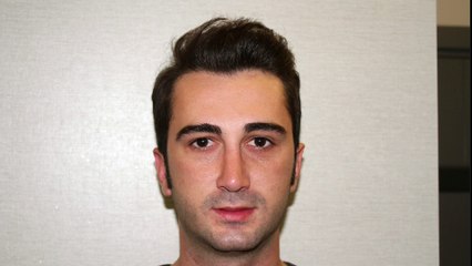 Mustafa Ali Yanık burunda şekil bozukluğu şikayet ile başvuran hastalarının sonuçlarını paylaşıyor