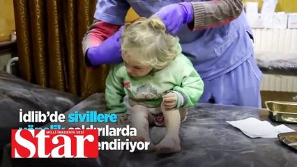 Esed�in kimyasal silah mağdurları konuştu