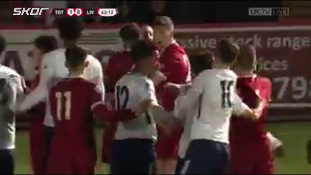 Lallana U23 maçında çıldırdı