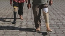 Indonesios reciben prótesis nuevas gracias al programa de movilidad de Aceh