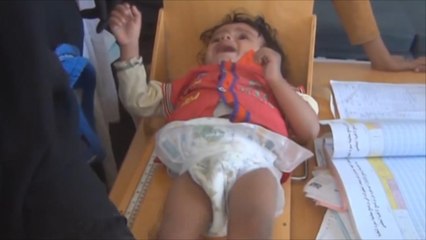 اليمن: ثلاثة أرباع السكان يحتاجون مساعدات