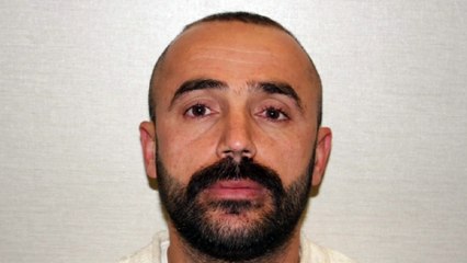 Op Dr Mustafa Ali Yanık burun da şekil bozukluğu şikayet i ile gelen hasta sonuçlarını paylaşıyor.