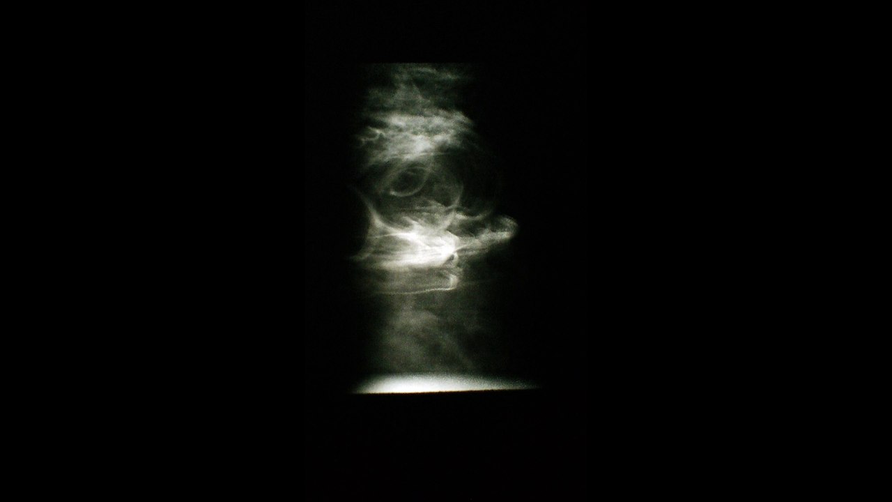 Strange Things
