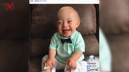 First Baby with Down Syndrome Wins Gerber Baby of 2018