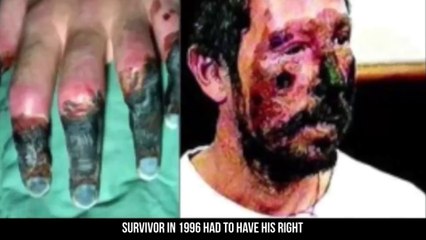 7 REASONS Not Climb Mt Everest