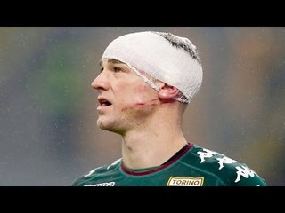 Top 10 Horrific Injuries In Football 2017 •  OUCH!