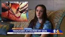 Teen Says She Felt Like a Chew Toy During Vicious Dog Attack