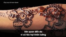 Xăm và dán decal henna: tưởng vô hại nhưng lại nguy hiểm khôn lường