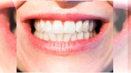 Charcoal Teeth Whitening Review