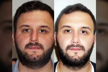 Mustafa Ali Yanık burunda şekil bozukluğu şikayet ile başvuran hastaları ve sonuçlarını paylaşıyor