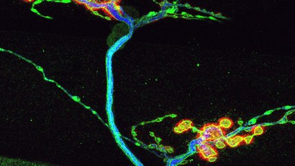 Jonction neuro-musculaire