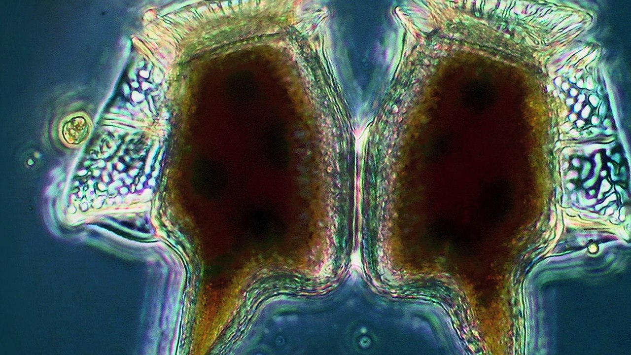 Micro-algues toxiques