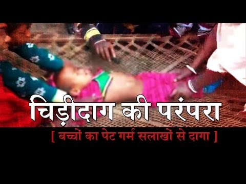 Children who play the tradition of stained stomach hot bars in jharkhand II चिड़ीदाग की परंपरा