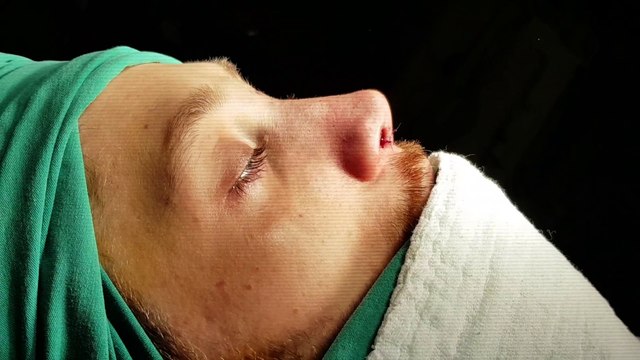 Op Dr Mustafa Ali Yanık Başarılı bir burun estetiğinin önemini anlatıyor. Mustafa Ali Yanık burun şikayet ve çözümleri