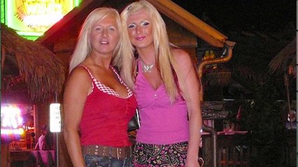 10 Craziest Stories Of Plastic Surgery Obsessions