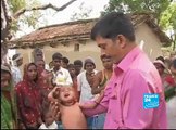 FRANCE24-EN-Report- Malnutrition problems in India