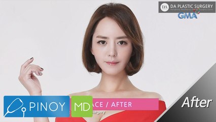 Pinoy MD: South Korea's plastic surgery culture
