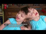 휴먼다큐 사랑 - 말괄량이 샴쌍둥이, 시각, 미각을 공유하는 샴쌍둥이 타티아나와 크리스타! 20140602