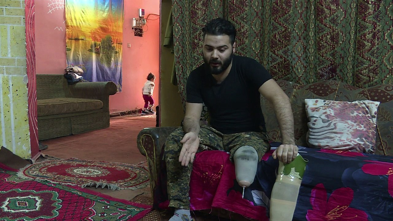Irakische Kämpfer - verwundet fürs Leben