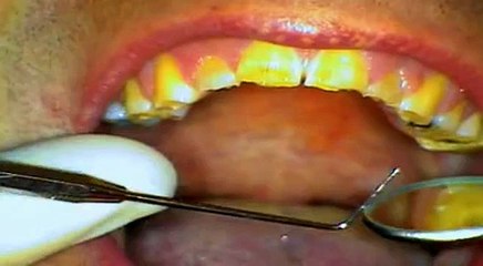 Embarrassing Bodies S02E03