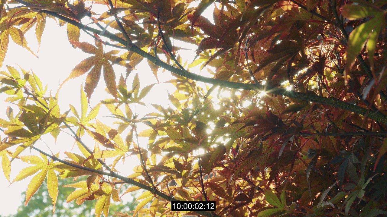 BELVEDERE KERRY KATONA-Liposuction and Tummy Tuck