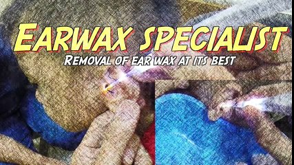 Woman's Huge Earwax Removal